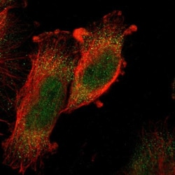 PRAK Antibody, Novus Biologicals:Antibodies:Primary Antibodies